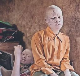 Secuestran a albinos en Tanzania brujería ¿qué medidas han tomado las autoridades?
