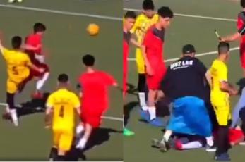 Futbolista de 17 años fallece en pleno partido por patada en el rostro 
