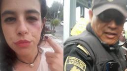 Mujer denuncia agresión de policía, autoridades no le hacen caso