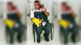 Lomas Verdes: Oficial recibe batazo en la cabeza 