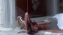 Hombre se desangra en la puerta de un hospital en Álvaro Obregón 