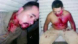 Torturados escapan de 'La Unión de Tepito' y libran asesinato