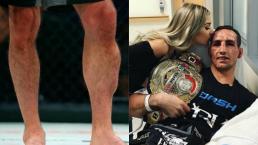 Peleador de artes marciales muestra escalofriante fractura en pierna
