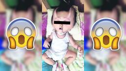 Le salen cuernos a nene tras operación, en Filipinas