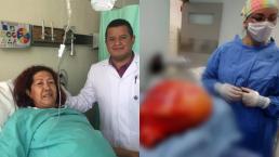 Extirpan tumor abdominal de 17 kilos a una mujer, en Hospital del IMSS en Durango 