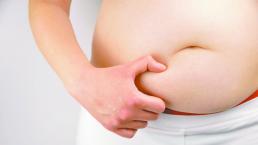 Cámara de Diputados aprueba cirugías contra gordura, en Chile