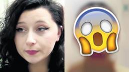 Reacción alérgica a tinte le deja daños espeluznantes a chica francesa 