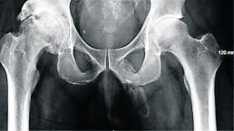 abuelito radiografía doctor pene genitales hueso estados unidos