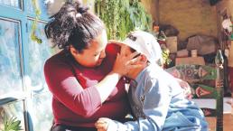 Mamá de niño de 9 años pide ayuda, su hijo se quemó con agua hirviendo en Toluca