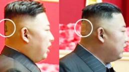 Kim Jong-un reaparece en público con una mancha en la cabeza, se especula sobre su salud