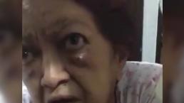 Abuelita de 83 años denuncia a su hijo por golpearla brutalmente, en la Ciudad de México