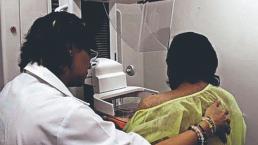 Gobierno de Morelos invita a mujeres a realizarse mastografías gratuitas