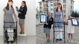 Ella es Rumeysa Gelgi, la mujer turca más alta del mundo
