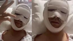 Actor de Televisa se quema la cara tras accidente, comparte imágenes en Instagram