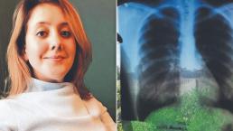 La increíble historia de la adolescente rusa que tiene los órganos al revés