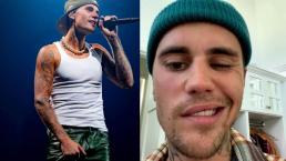 Justin Bieber cancela gira porque tiene la cara paralizada, esto le pasó