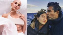 Ella es la modelo con alopecia que se hizo viral, por ser novia de la hija de Raúl Araiza