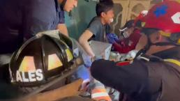 "Ya perdí la mano", trabajador de 20 años sufre grave accidente y su mamá lo anima en Ecatepec