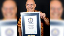 ¡Ay ojón! Brasileño llega a los récords Guinness por su habilidad de expulsar los ojos