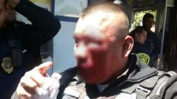 Asaltantes dan golpiza a poli en Iztapalapa