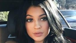 Kylie Jenner confiesa que se inyectó los labios