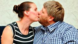 Hombre no podía besar a su esposa por rara enfermedad