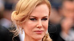 Nicole Kidman se arrepiente de usar botox