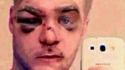 Hombre es brutalmente golpeado por maltratar a su perro | VIDEO