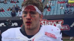 Jugador de americano se rompe la cabeza | VIDEO